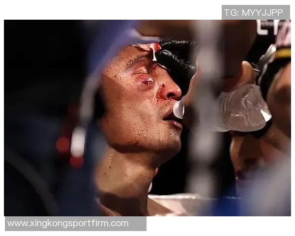 亨特谈比赛表现：提高出手次数保持侵略性同时注重组织进攻